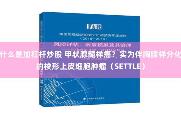 什么是加杠杆炒股 甲状腺髓样癌？实为伴胸腺样分化的梭形上皮细胞肿瘤（SETTLE）